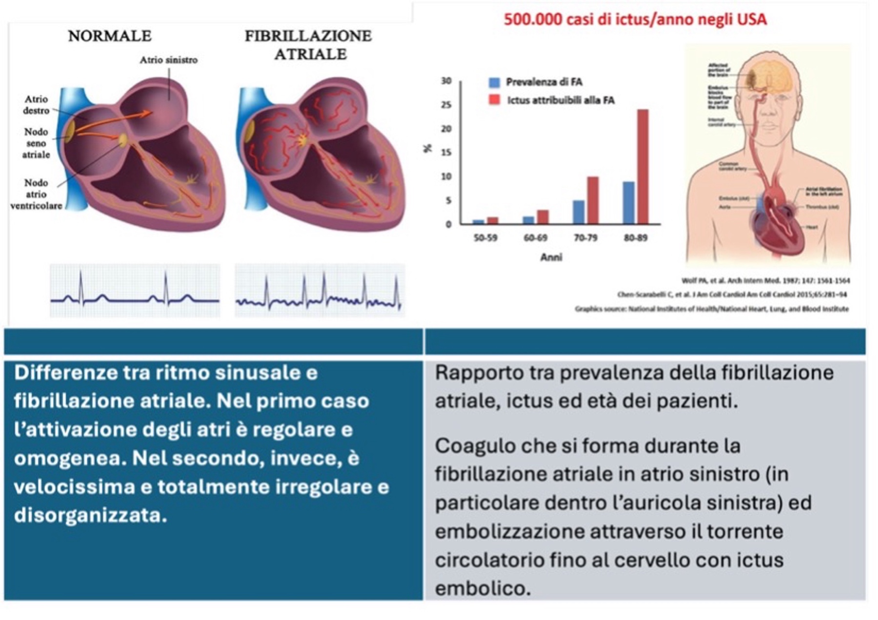 Fibrillazione atriale — Dott. Alessandro Blandino